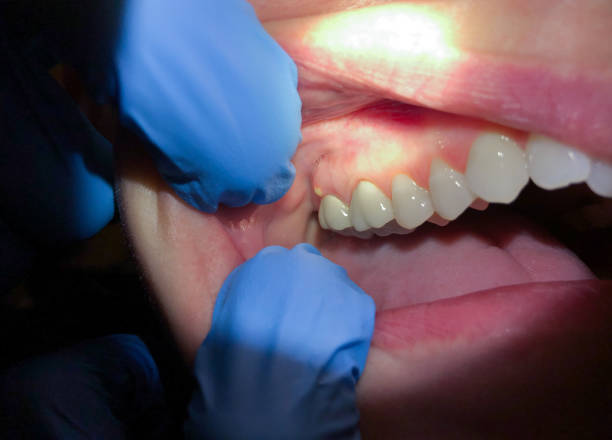 Best Orthodontic Emergency Dentist in Monticello, IL