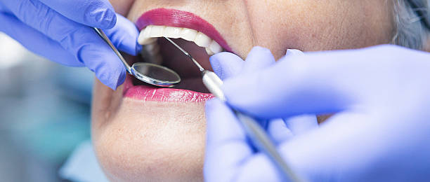 Best Emergency Cosmetic Dentistry in Monticello, IL
